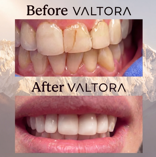 VALTORA Nano-Hydroxyapatite Toothpaste